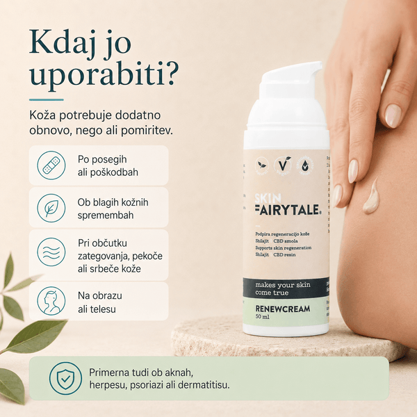 Image of the Renew Cream product - SkinFairytale